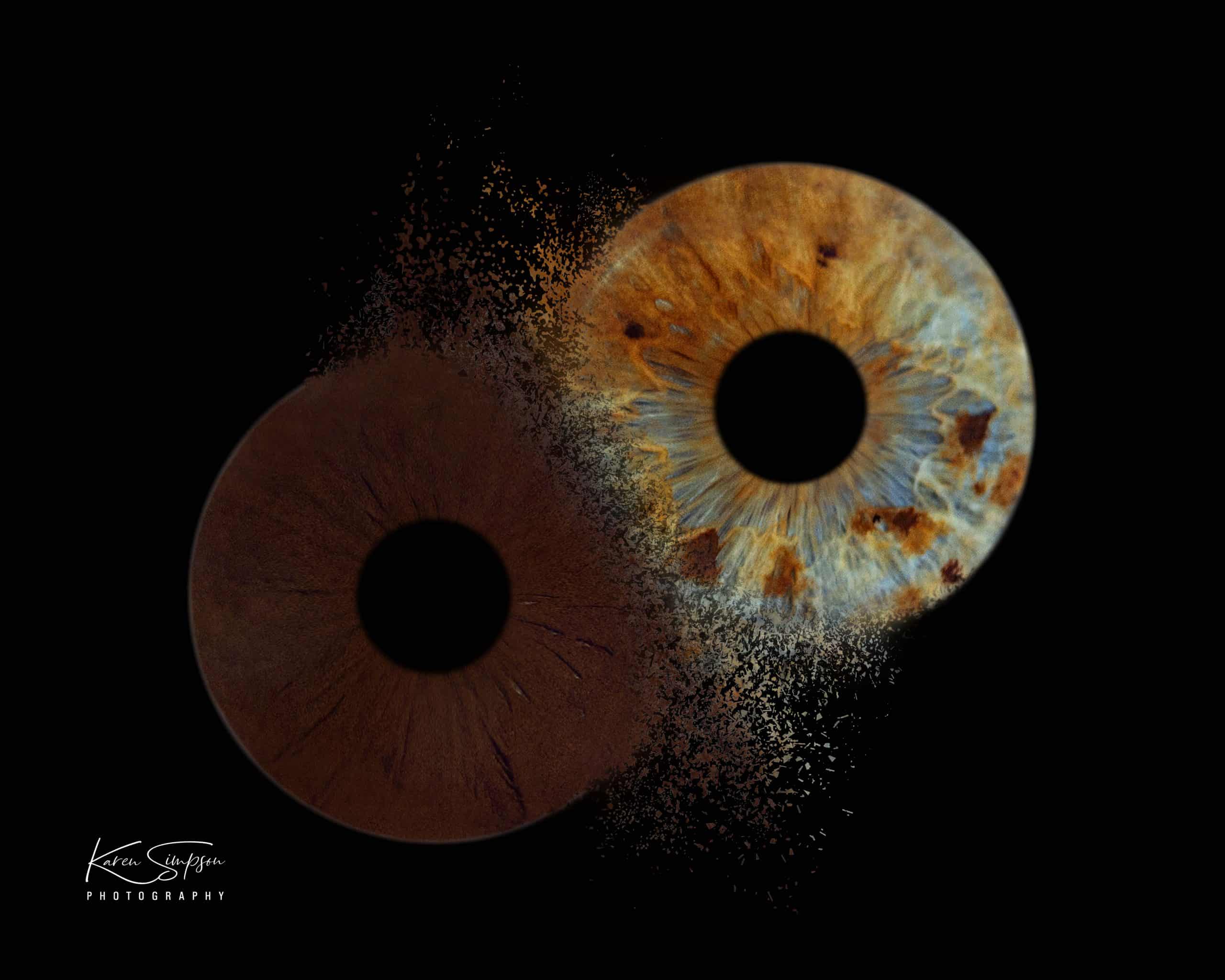 The Health and Functional Role of Your Iris Colour